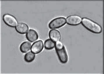 Ryc. 2 – Kolonia drożdży Zygosaccharomyces sp.; (Fot. źródło: Wikipedia)